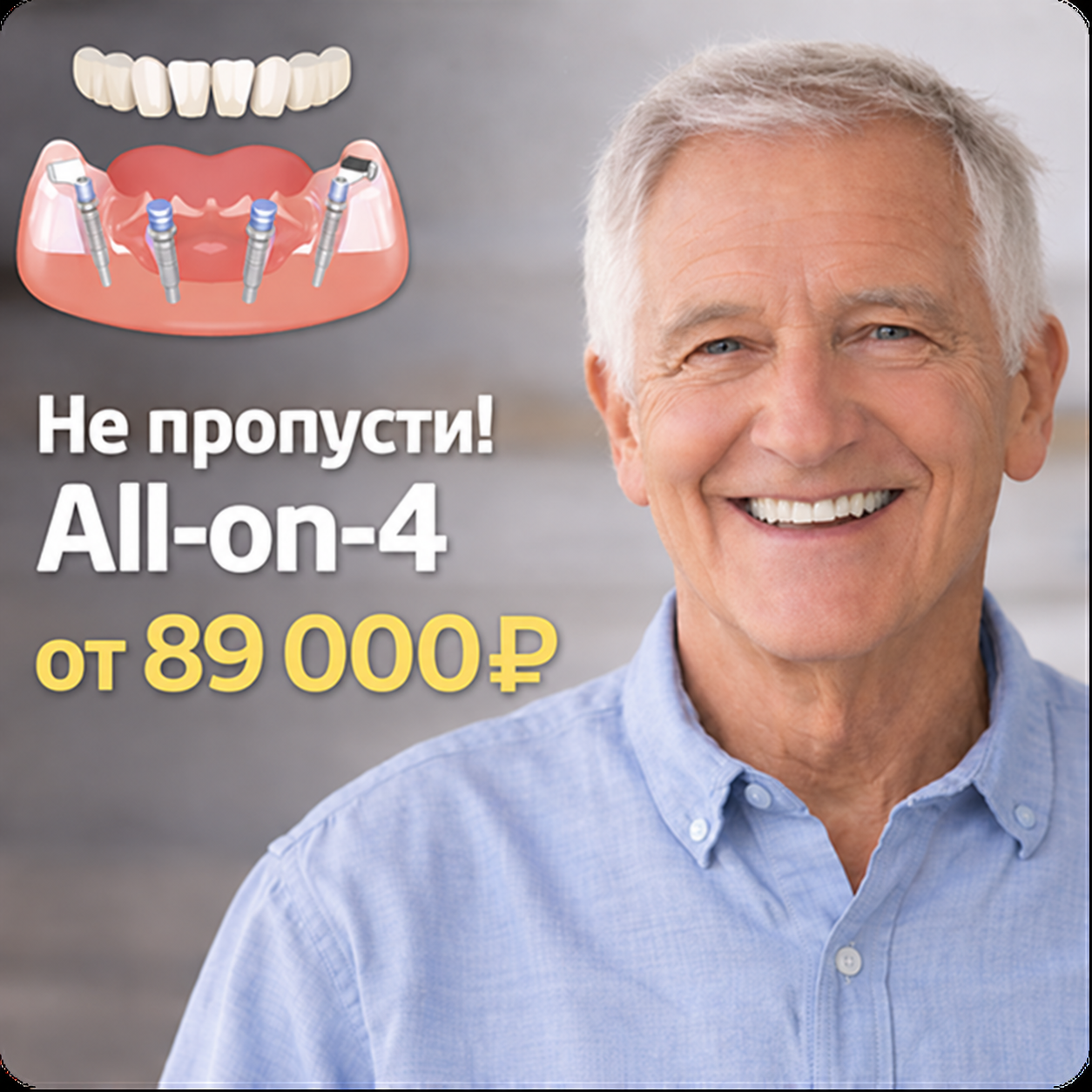 Не пропусти! All-on-4 от 89 000₽