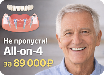 Не пропусти! All-on-4